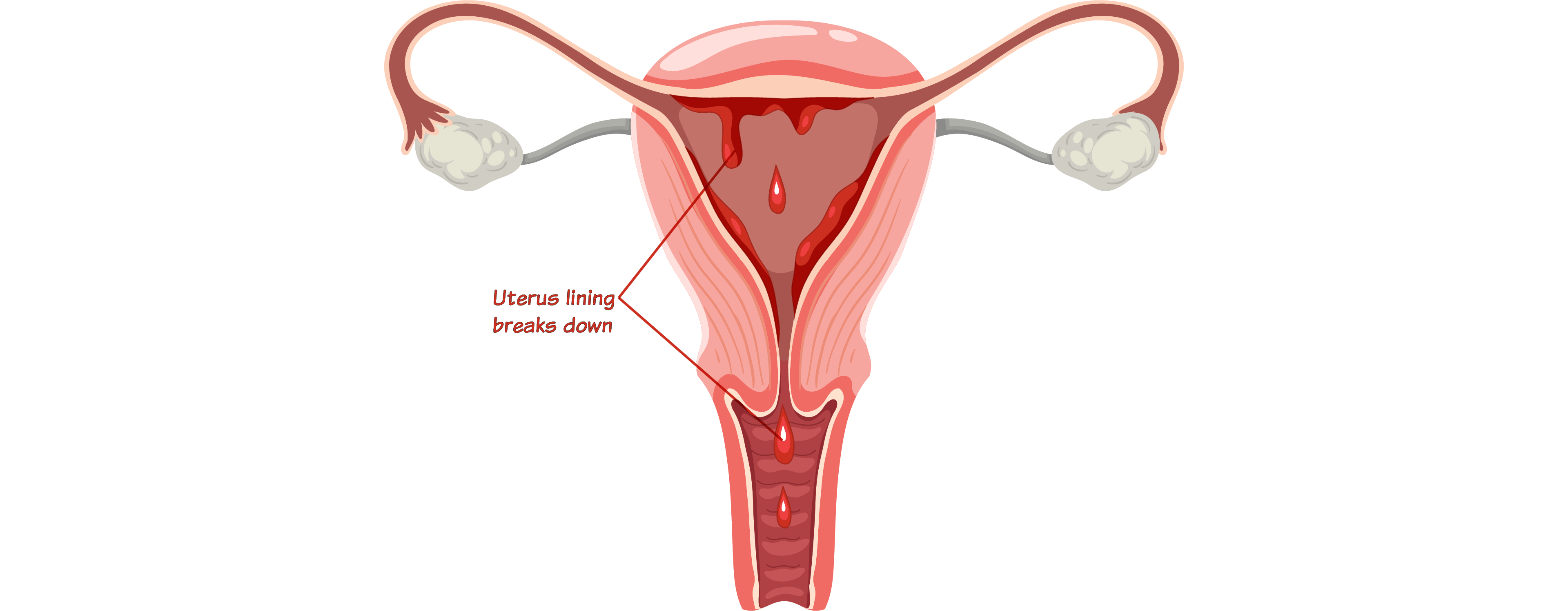Stage 1