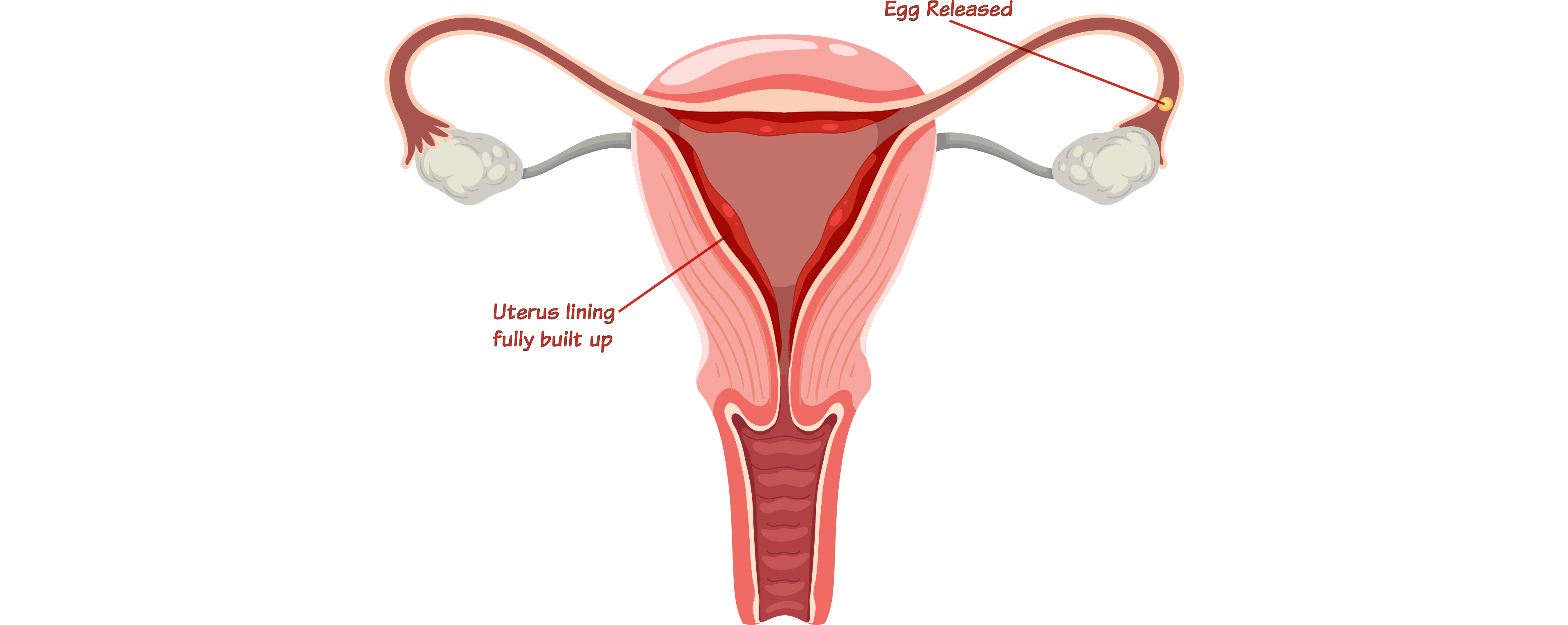 Stage 3